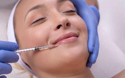 How Long Do Dermal Fillers Last?